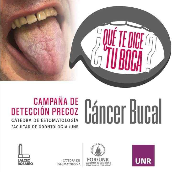 cancer_bucal_01